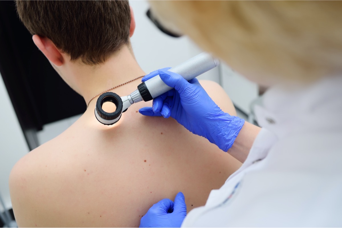 a doctor examines a spot on a patient's back
