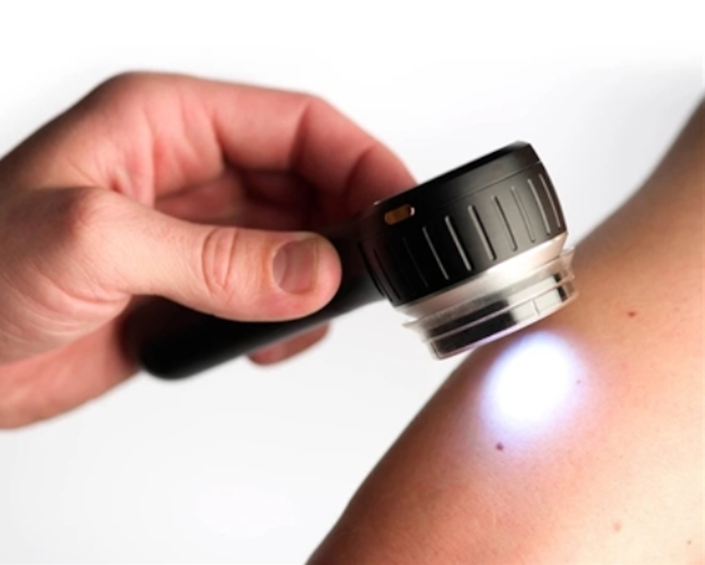 a doctor examines skin using a modern dermoscope